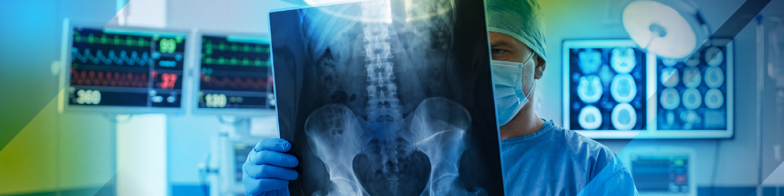 Male technician in x-ray lab studying an x-ray.