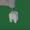 Tooth Cavity Animation